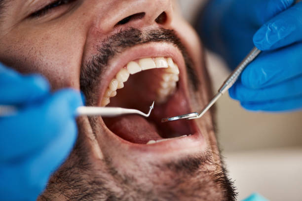 Best Emergency Dental Care for Broken or Chipped Teeth in Brooklawn, NJ